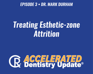 Treating Esthetic-zone Attrition