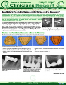 Teeth Connected to Implants 0124 ST